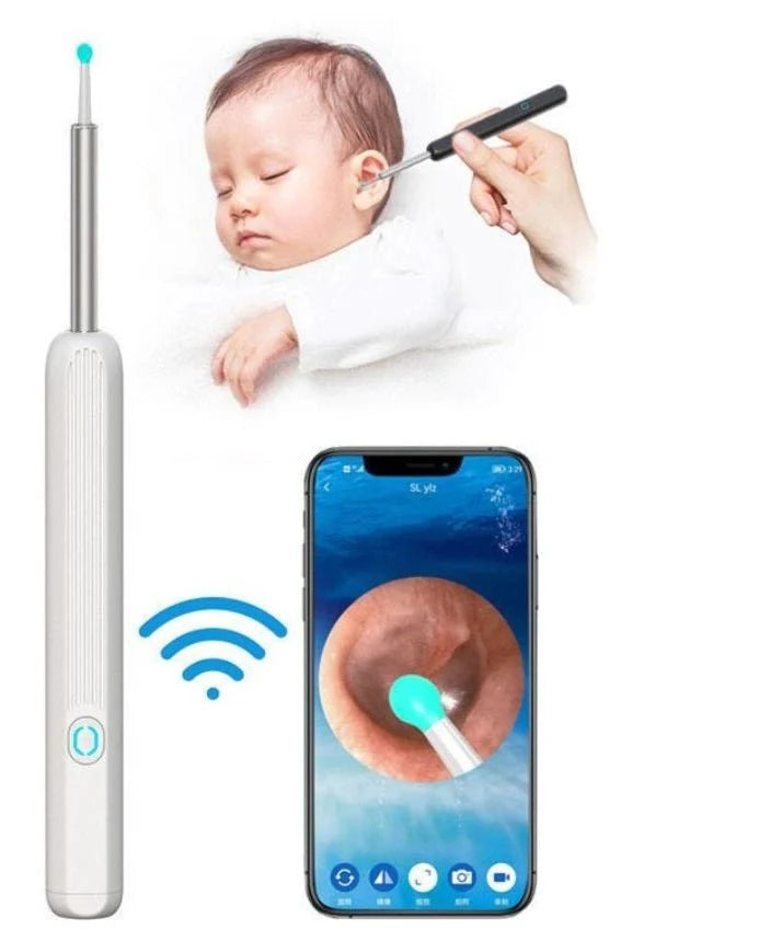 Smart Visual Ear Wax Remover with HD Camera – Safe Ear Cleaning Kit | Fast UAE Delivery