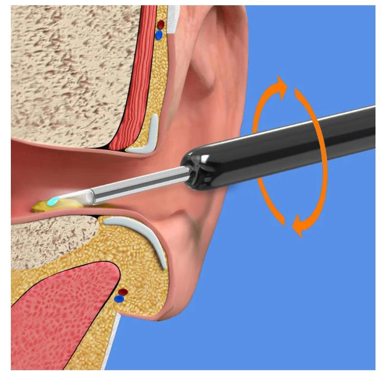 Smart Visual Ear Wax Remover with HD Camera – Safe Ear Cleaning Kit | Fast UAE Delivery