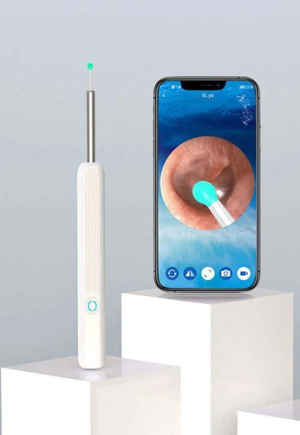 Smart Visual Ear Wax Remover with HD Camera – Safe Ear Cleaning Kit | Fast UAE Delivery
