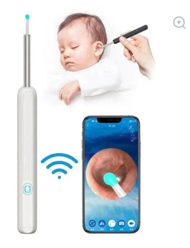 Smart Visual Ear Wax Remover with HD Camera – Safe Ear Cleaning Kit | Fast UAE Delivery